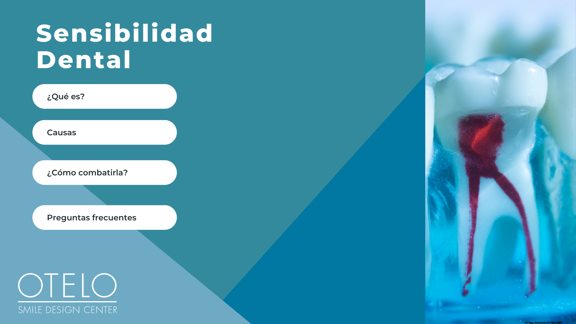 información sensibilidad sensibilidad dental